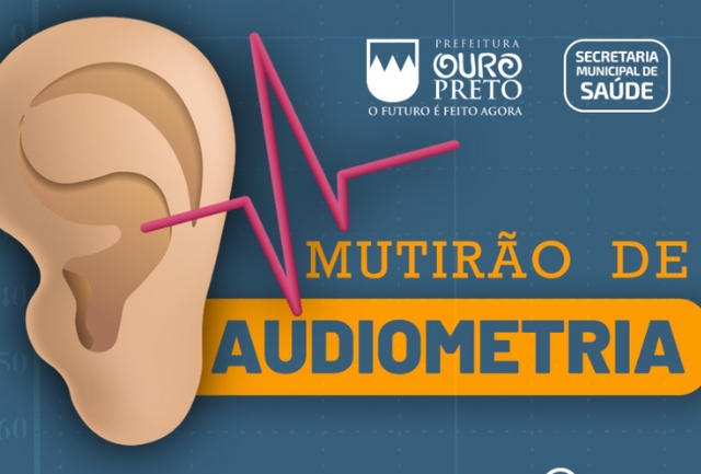 Secretaria Municipal de Saúde vai ligar para os pacientes que estão na fila do exame e marcar o dia, o local e o horário do atendimento na clínica Íris. Foto do banner de divulgação.